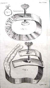 tourniquet, print, 18th century.jpg (58720 bytes)